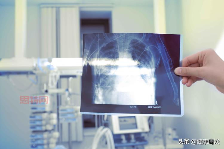 WiFi辐射会危害健康吗？蚂蚁庄园答案解析