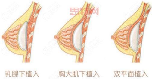 深度解析“豪乳”吸引力：你不可错过的热门话题！